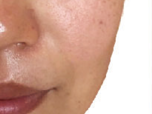 トリートメント前
